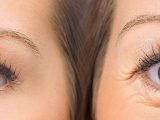 How to get rid of sunken eyes naturally