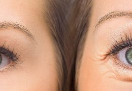 How to get rid of sunken eyes naturally